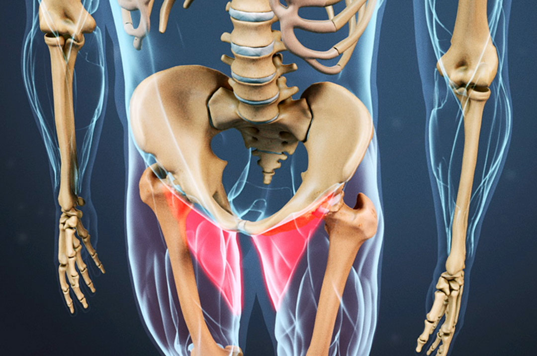 Adductor (Groin) Injuries in Soccer Players Active PT Sports