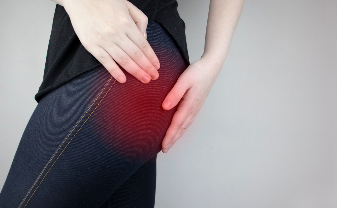 Piriformis Syndrome - Running Is a Pain in the Butt
